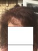 10-22-17 in sun air dried hair friar tuck mask.jpg