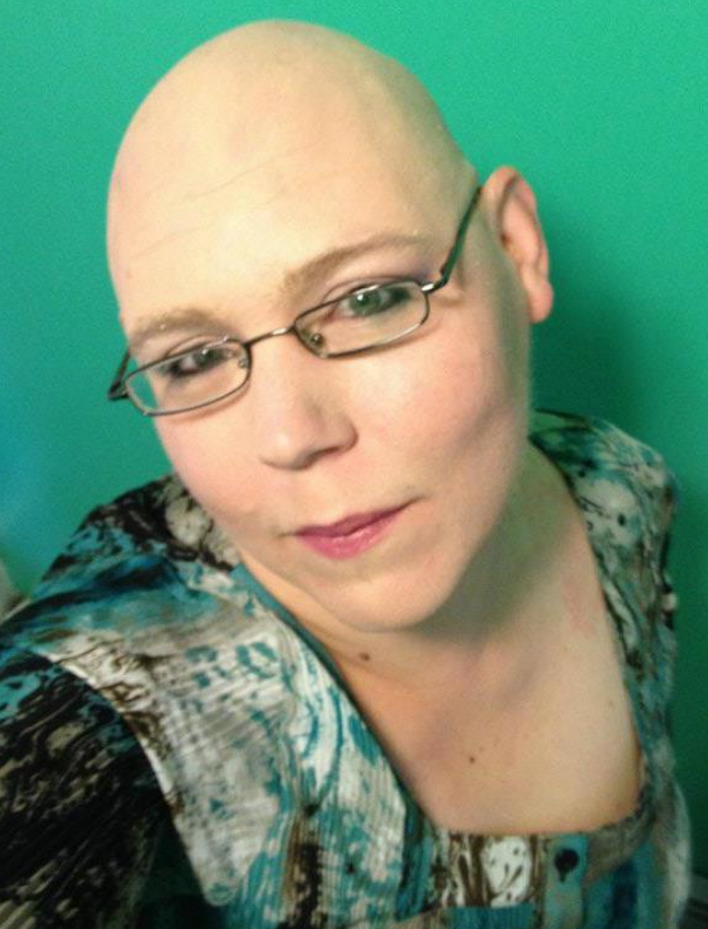 104192d1354131347-men-would-you-date-bald-woman-screen-shot-2012-11-28-2.35.png
