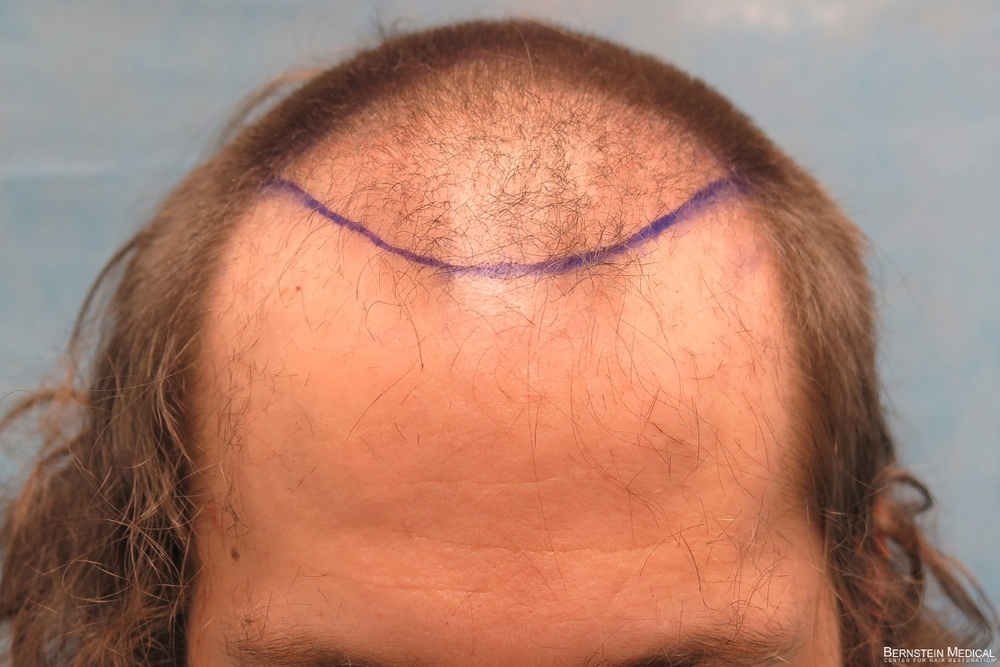1c_hair-clipped_rsi.jpg