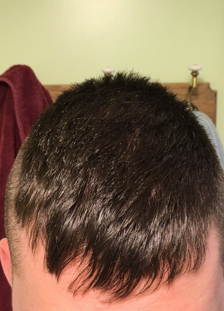 2 Top down normal under light.jpg