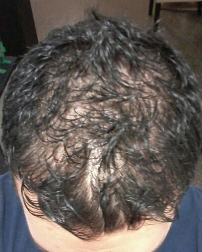 2017-01-04-21-22-12-jpg.46782