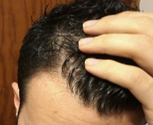 2017-01-04-21-24-14-jpg.46783