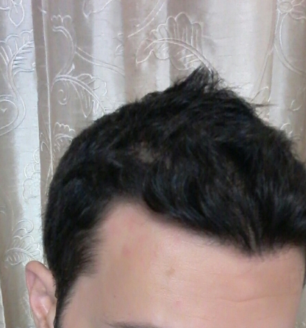 2017-01-04-21-54-29-jpg.46785