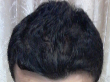 2017-01-04-21-55-12-jpg.46784