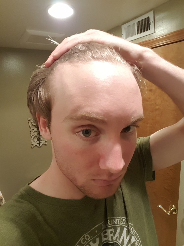 Please Let Me Know If My Crown Is Thinning. 20 Years Old