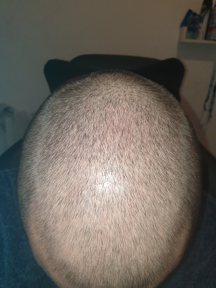 20210313_134835 same lighting.jpg