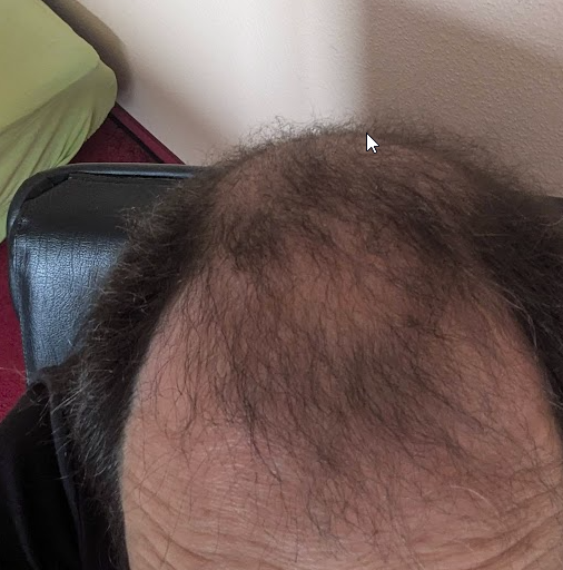 2026-02-19 16_29_05-Foto - Google Fotos.png