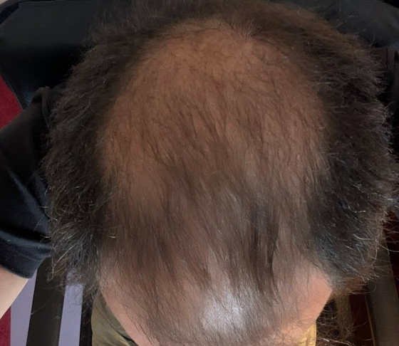 2026-02-19 16_29_37-Foto - Google Fotos.png