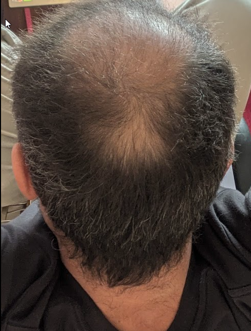 2026-02-19 16_30_03-Foto - Google Fotos.png