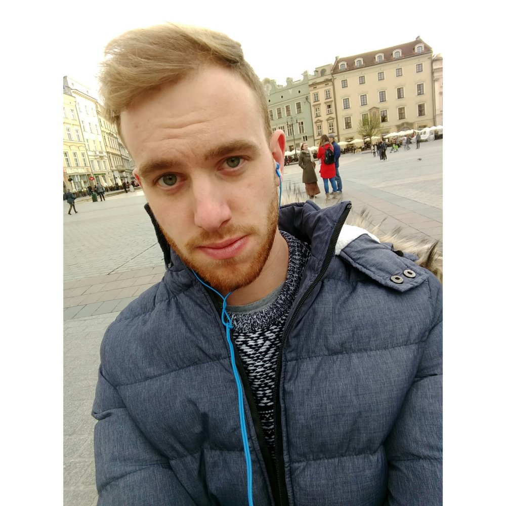 System Too Dense And Colour Incorrect HairLossTalk Forums