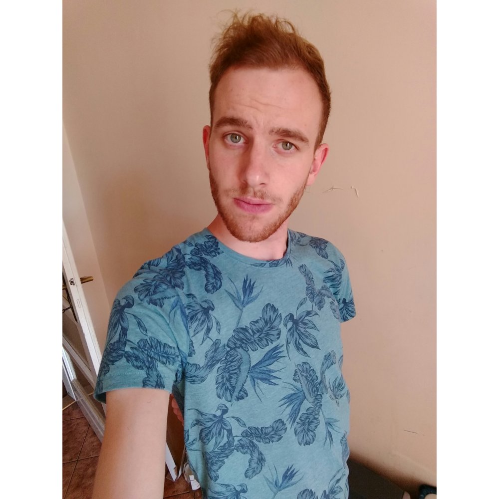 System Too Dense And Colour Incorrect HairLossTalk Forums