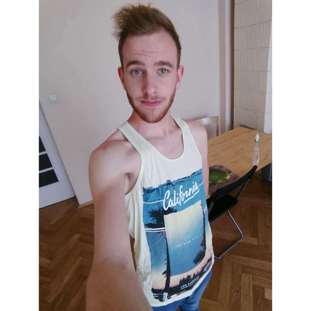 System Too Dense And Colour Incorrect HairLossTalk Forums