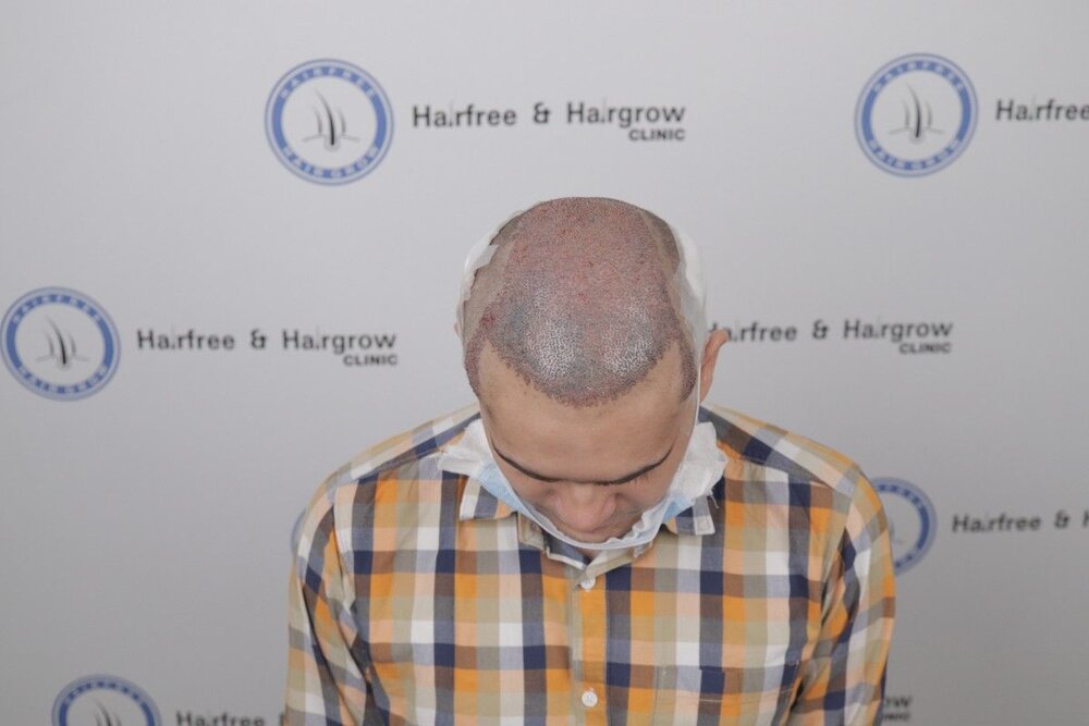 after transplant.JPG