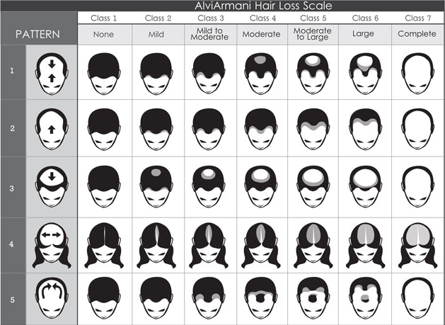 alvi-armani-hair-loss-scale.jpg