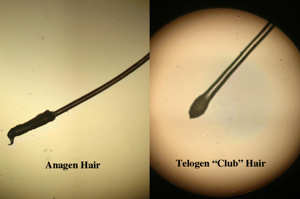 Anagen-versus-telogen-hairs-under-microscopy.png