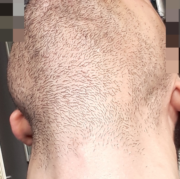 barba-1-mese-d.jpg