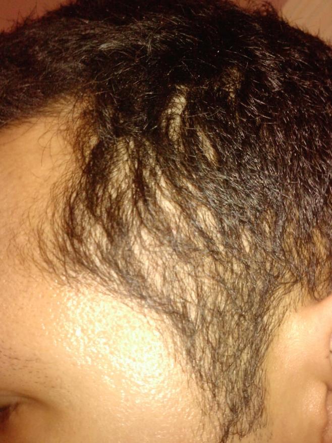 My results with Divine Herbal hair oil | HairLossTalk Forums