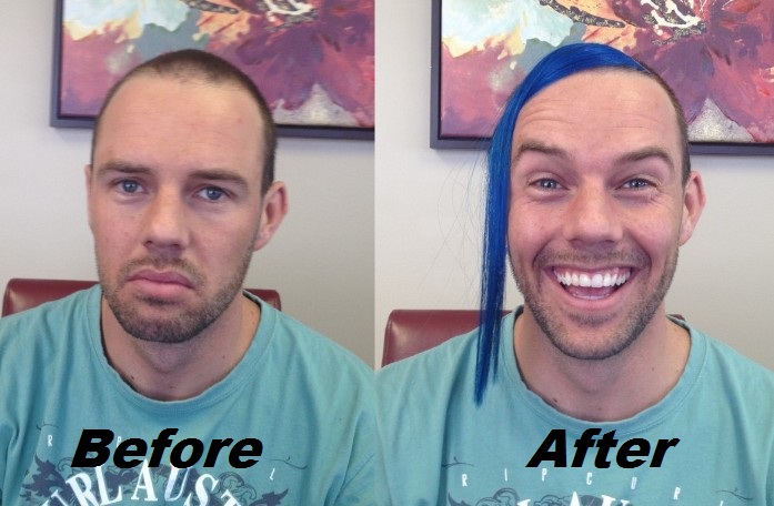 Before-after-shane.jpg