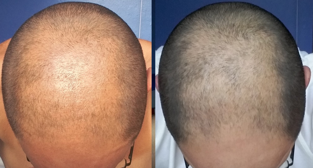 Before and After.jpg