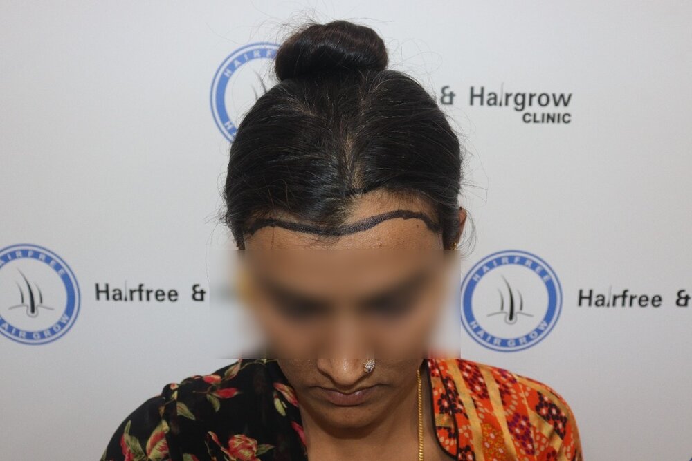 Before transplant (1).JPG