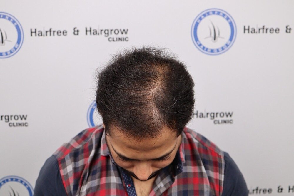 before transplant.JPG