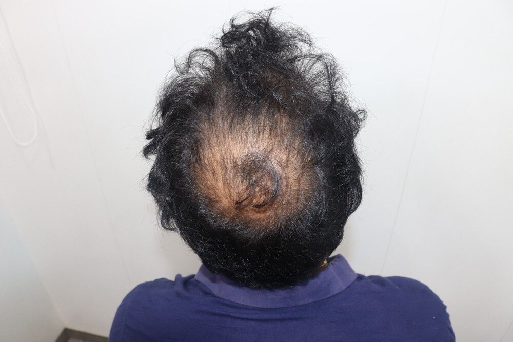 before transplant.JPG