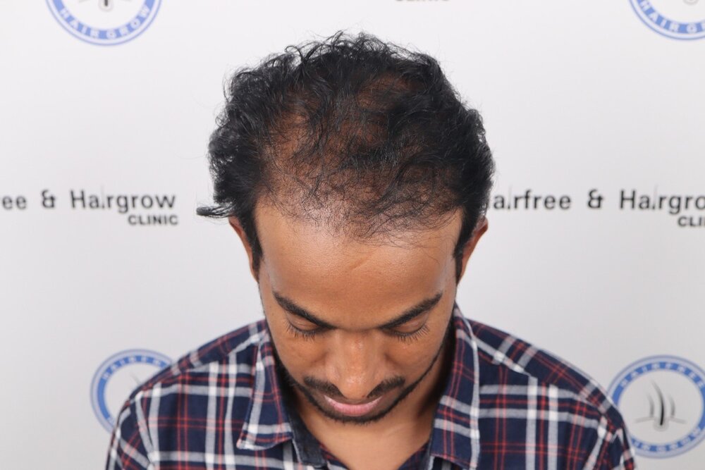 before transplant when he visited.JPG