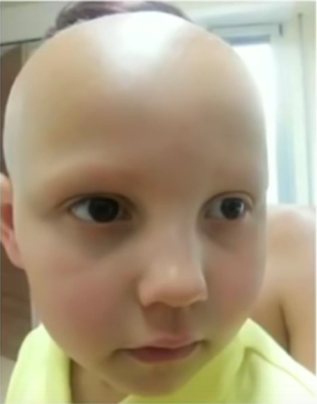 Before treatment.png