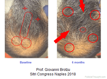 (Brotzu, 2018) Sitri Congress Proceedings.png