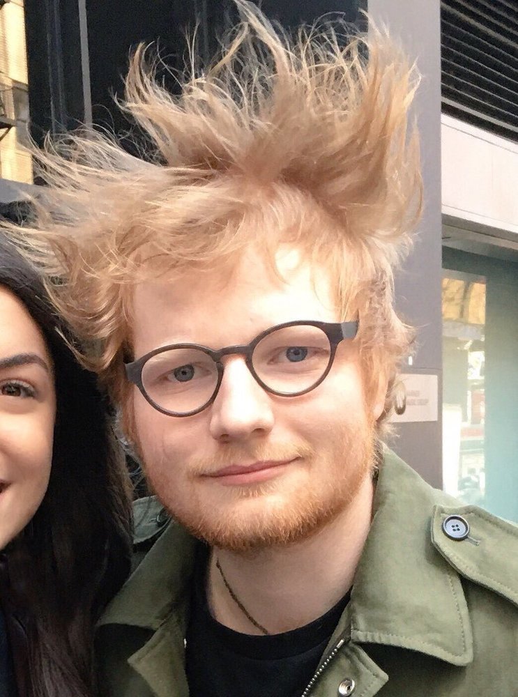 Take That (music Band) Fear Going Bald | HairLossTalk Forums