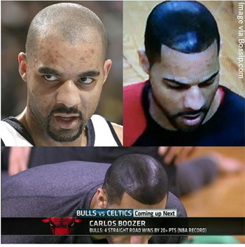 Carlos-Boozer-Before-and-After-his-Shoe-Polish-Hair-Look-to-Hide-Hair-Loss.jpg