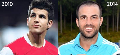 cesc-fabregas-receding-hairline-hair-loss-balding-belgravia-centre1.jpg