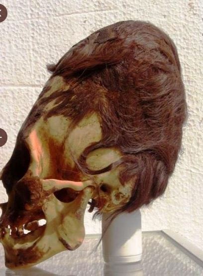 craneo deformado con cabello paracas peru.JPG