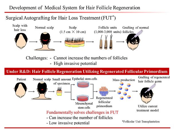 Development-of-Medical-System-for-Hair-Follicle-Regeneration-English-version.jpg