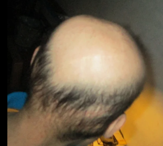 dfcb8c7be836dc6e15698a3f056eef6c.png