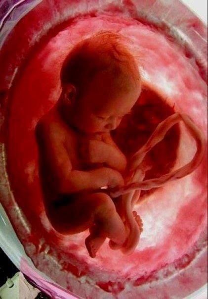eb47ef28ee3299b2cd59a3b5babf16aa--choose-life-pro-life.jpg