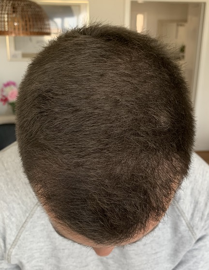 Efter 3 Månader.1.jpg