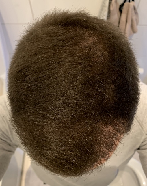 Efter 3 Månader.3.jpg