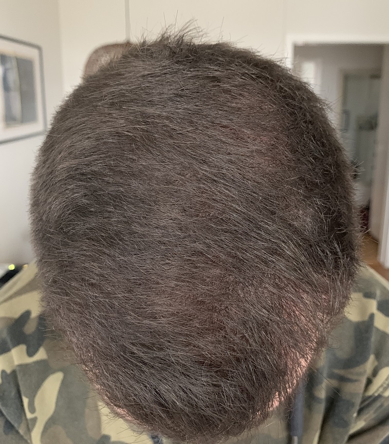 Efter 6 Månader.1.JPG