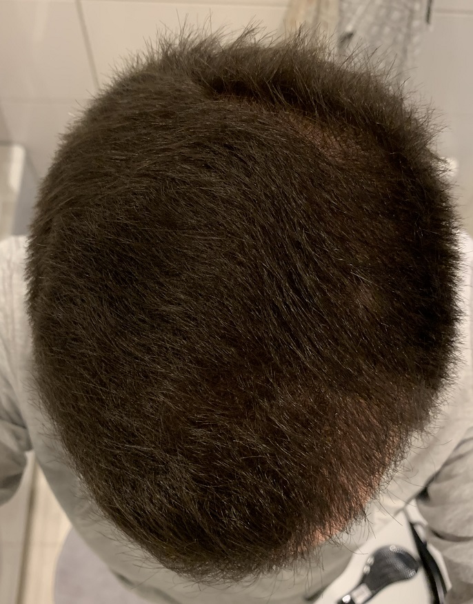 Efter 6 Månader.3.JPG