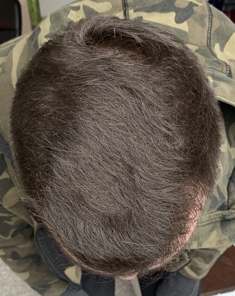 Efter 9 Månader.1.jpg