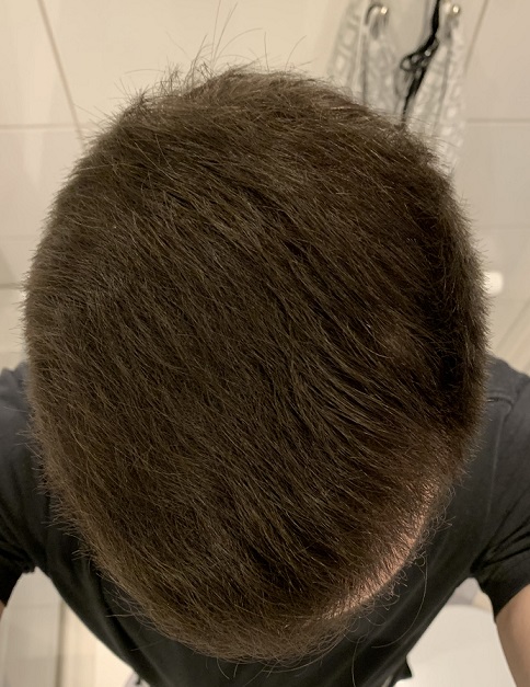 Efter 9 Månader.3.jpg