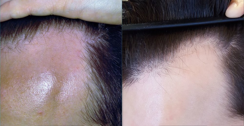 Feb 2016 vs Oct 2017 2.JPG