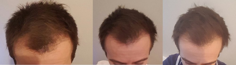 Fina comparaison 2.jpg