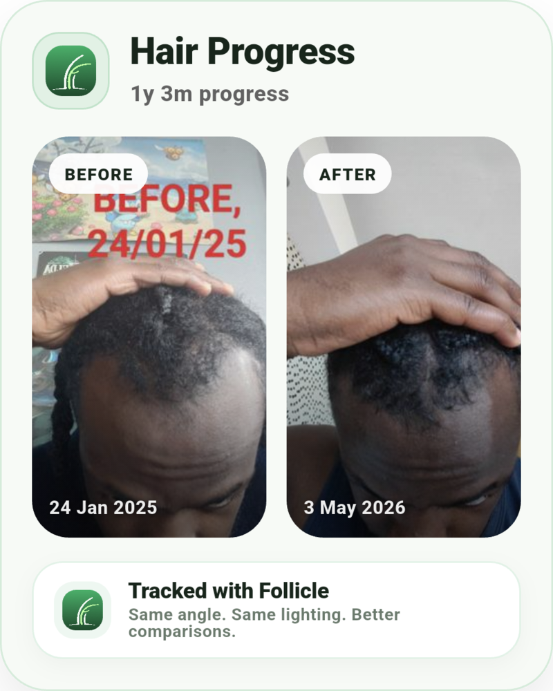 follicle_progress_card_1782489730324.png.png