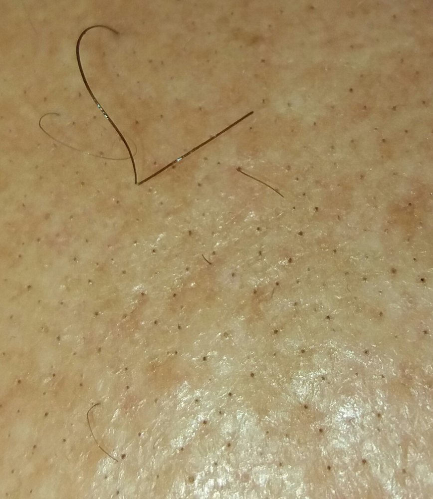 foro HairLossTalk.com 1.jpg