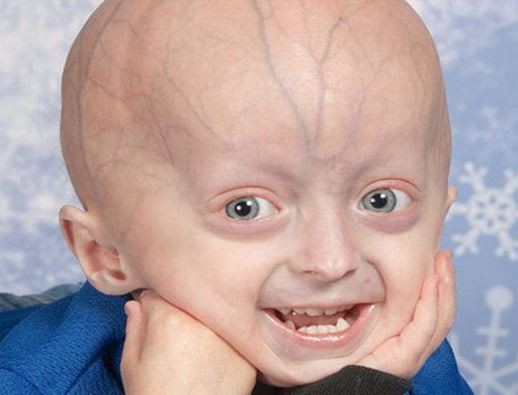 Genetic Disorder.jpg