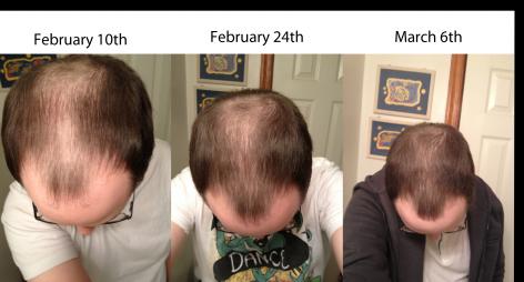 hair-timeline-jpg.jpg
