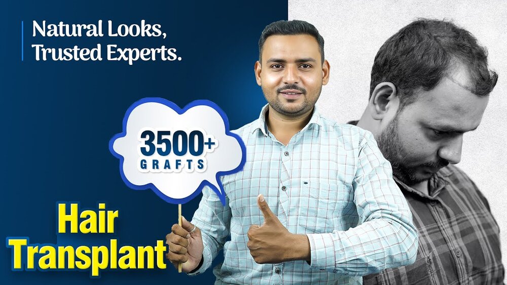 Hair Transplant Journey of Pravin Kapade.jpg