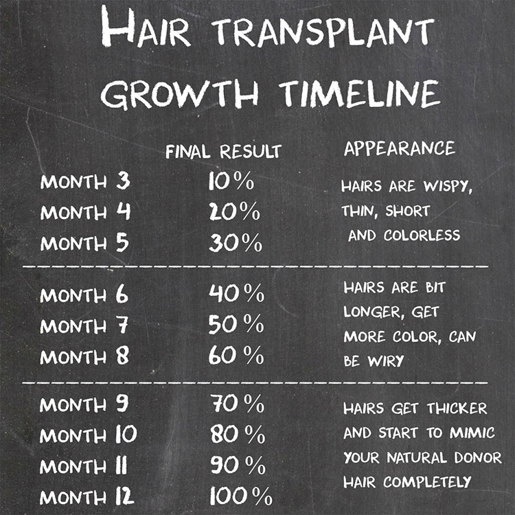 Hair Transplant Timeline, What % Of Grafts Sprout By... | HairLossTalk  Forums